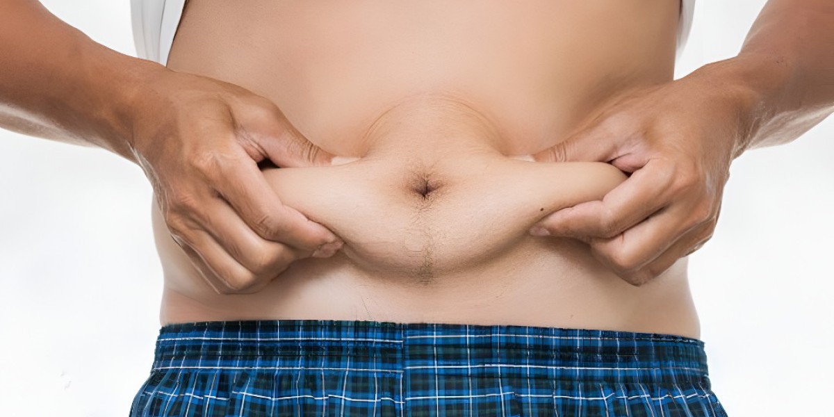 Tummy Tuck Surgery in Islamabad: Frequently Asked Questions Answered