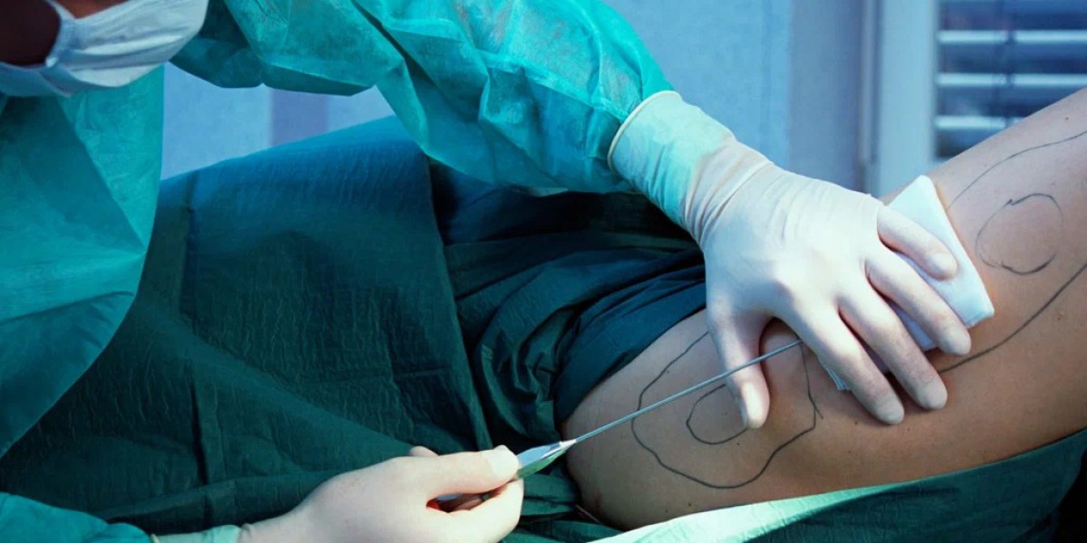 How Much Does Liposuction Cost in Pakistan
