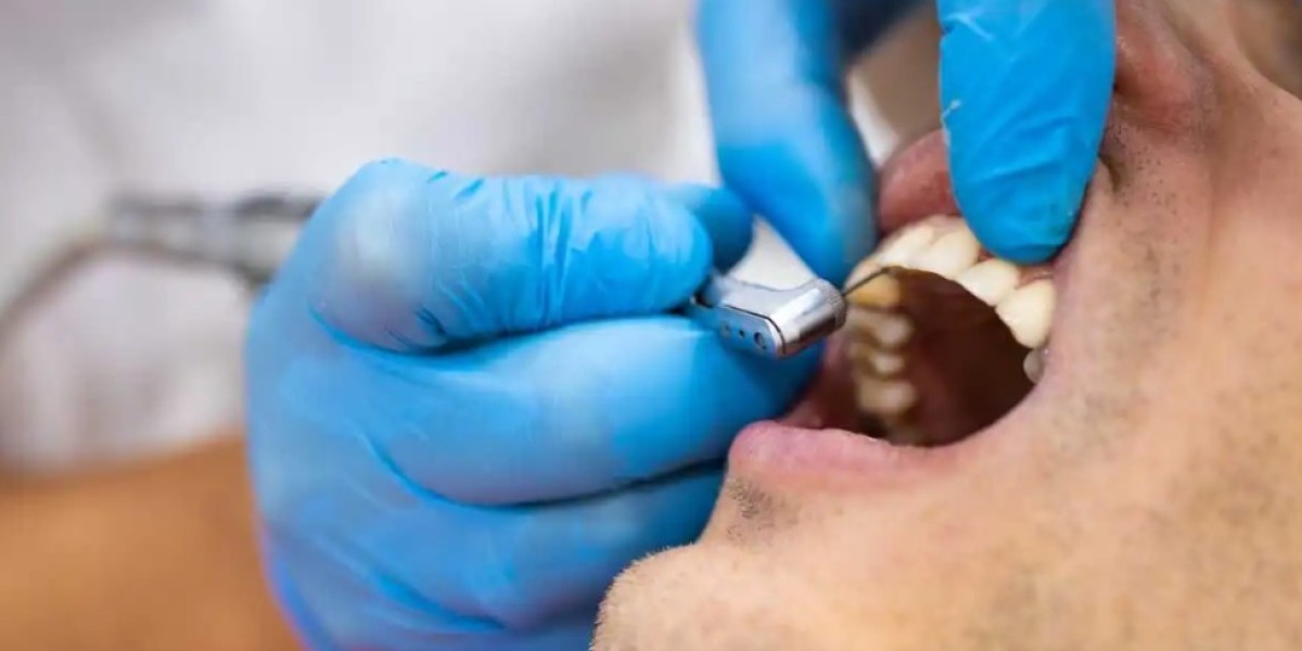 Unlocking Your Best Smile: Realistic Expectations for Aesthetic Treatments