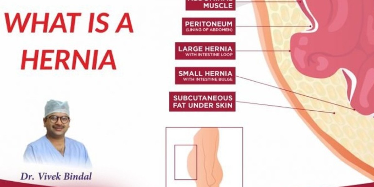Best Hernia Surgeon in Solan: A Complete Guide to Symptoms, Treatment, and Recovery